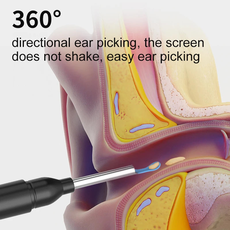 Ear Scope Pro with camera